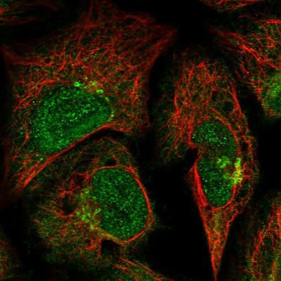 Immunocytochemistry/Immunofluorescence: GCC185 Antibody [NBP1-89788] Staining of human cell line U-2 OS shows positivity in nucleus, cytoplasm & golgi apparatus.
