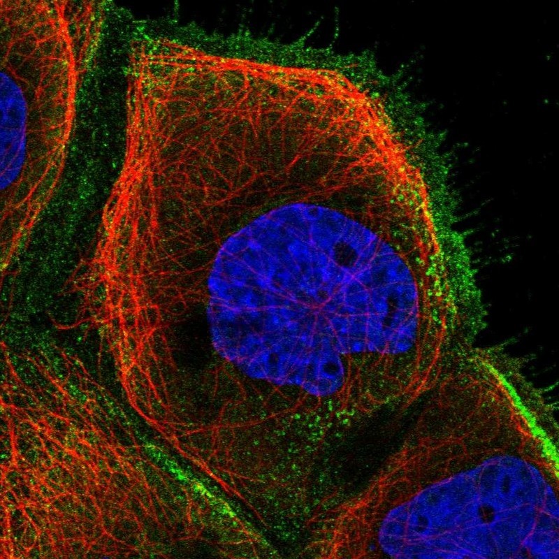 Immunocytochemistry/Immunofluorescence: NY-REN-50 antigen Antibody [NBP1-89903] - Staining of human cell line A-431 shows positivity in plasma membrane.