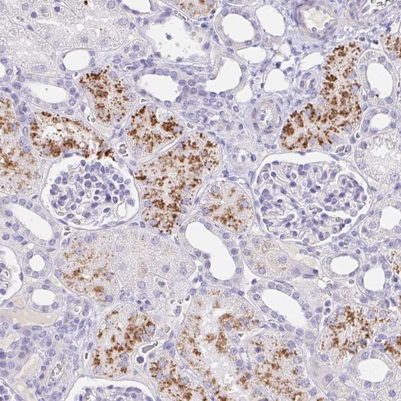 Immunohistochemistry: C4orf17 Antibody [NBP2-31819] - Immunohistochemical staining of human kidney shows strong cytoplasmic positivity in cells in tubules.