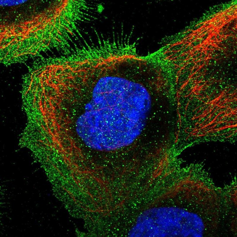 Immunocytochemistry/Immunofluorescence: KIF19 Antibody [NBP1-92054] - Staining of human cell line A-431 shows positivity in plasma membrane.