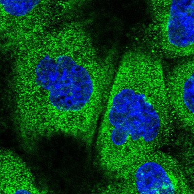 Immunocytochemistry/Immunofluorescence: MTR Antibody [NBP1-92146] Staining of human cell line A-431 shows positivity in cytoplasm.