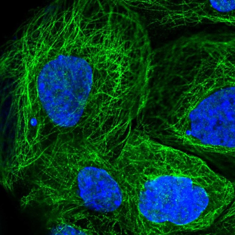 Immunocytochemistry/Immunofluorescence: SHPRH Antibody [NBP1-92387] - Staining of human cell line A-431 shows positivity in nucleus but not nucleoli & cytoskeleton (microtubules).
