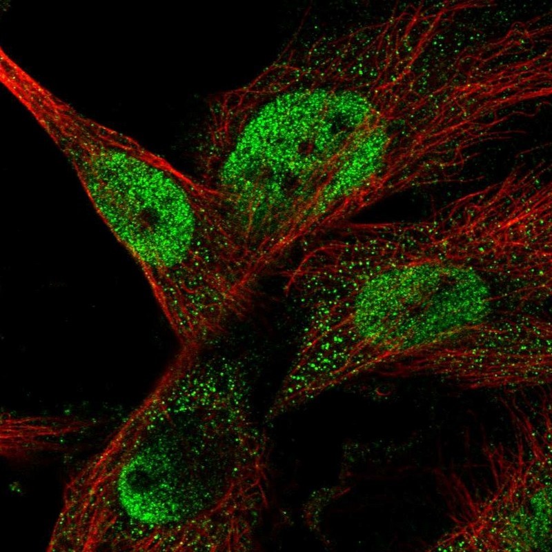 Immunocytochemistry/Immunofluorescence: SARP Antibody [NBP1-92363] - Staining of human cell line U-251 MG shows positivity in nucleus but not nucleoli & cytoplasm.