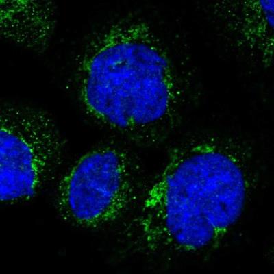 Immunocytochemistry/Immunofluorescence: Serine Palmitoyltransferase 2 Antibody [NBP1-92379] - Staining of human cell line A-431 shows positivity in mitochondria.