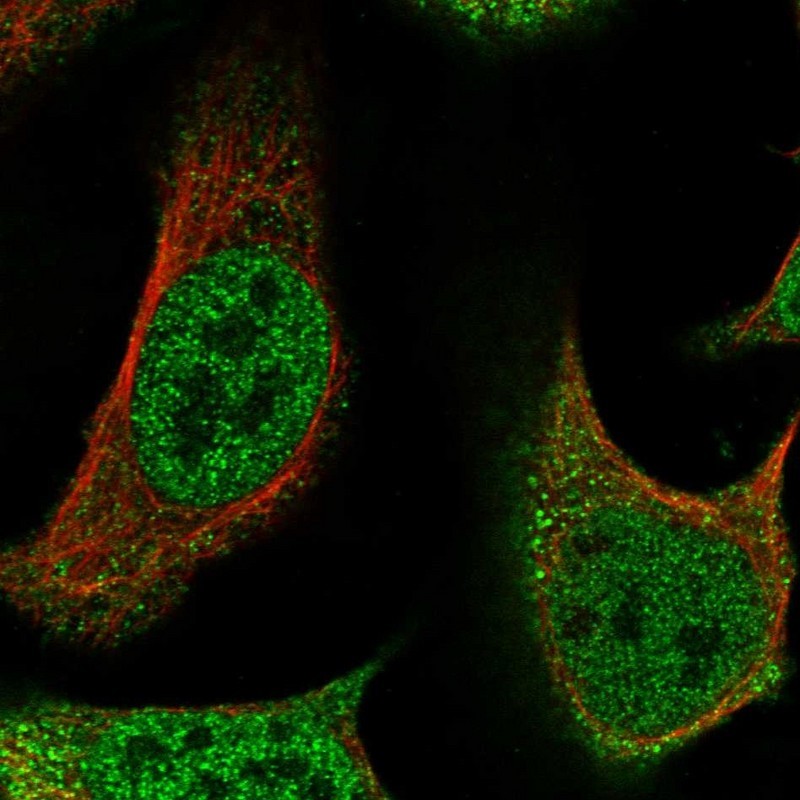 Immunocytochemistry/Immunofluorescence: CCDC107 Antibody [NBP1-93490] - Staining of human cell line U-2 OS shows positivity in nucleus but not nucleoli & cytoplasm.