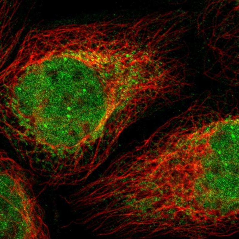 Immunocytochemistry/Immunofluorescence: HSF5 Antibody [NBP1-93782] - Staining of human cell line A-431 shows positivity in nucleus but not nucleoli & endoplasmic reticulum.