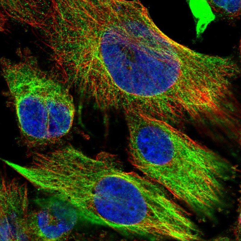 Immunocytochemistry/Immunofluorescence: C1orf168 Antibody [NBP1-93766] - Staining of human cell line U-251MG shows positivity in cytoplasm & cytoskeleton (intermediate filaments).