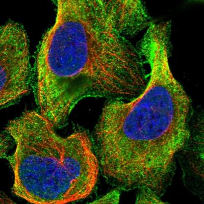 Immunocytochemistry/Immunofluorescence: TTLL5 Antibody [NBP1-93609] - Staining of human cell line U-2 OS shows positivity in plasma membrane & cytoplasm.