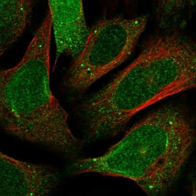 Immunocytochemistry/Immunofluorescence: KRTAP24-1 Antibody [NBP1-93665] - Staining of human cell line U-2 OS shows positivity in nucleus, nuclear membrane, cytoplasm & vesicles.