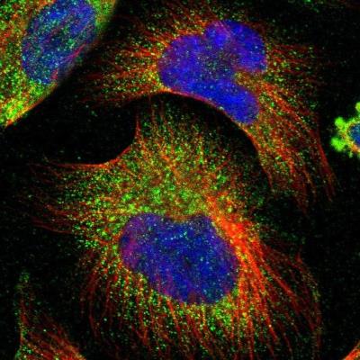 Immunocytochemistry/Immunofluorescence: IQSEC2 Antibody [NBP1-93632] - Staining of human cell line U-251MG shows positivity in vesicles.