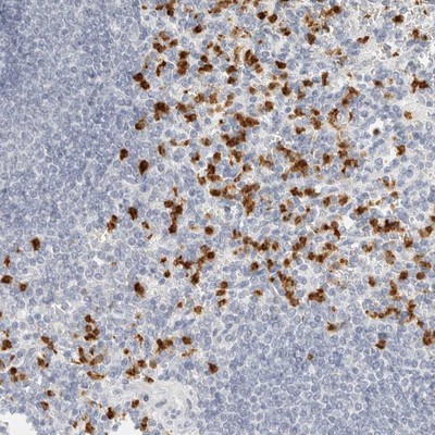 Immunohistochemistry-Paraffin: C1orf172 Antibody [NBP1-93839] - Immunohistochemical staining of human spleen shows distinct cytoplasmic and nuclear positivity in cells in red pulp.