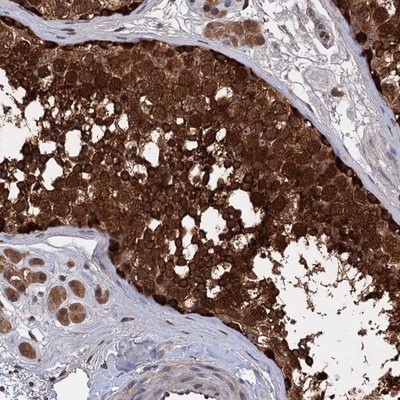 Immunohistochemistry-Paraffin: C15orf32 Antibody [NBP1-93868] - Staining of human testis shows strong cytoplasmic and nuclear positivity in cells in seminiferus ducts.