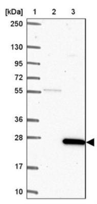 Western Blot: C15orf32 Antibody [NBP1-93867] - Lane 1: Marker [kDa] 250, 130, 95, 72, 55, 36, 28, 17, 10Lane 2: Negative control (vector only transfected HEK293T lysate)Lane 3: Over-expression lysate (Co-expressed with a C-terminal myc-DDK tag (~3.1 kDa) in mammalian HEK293T cells, LY407175)