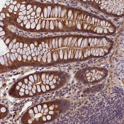 Immunohistochemistry: C15orf32 Antibody [NBP1-93867] - Staining of human colon shows strong cytoplasmic and membranous positivity in glandular cells.