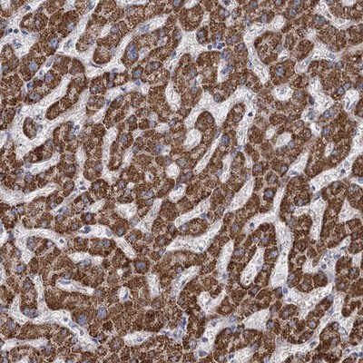 Immunohistochemistry-Paraffin: C10orf68 Antibody [NBP1-94025] - Staining of human liver shows strong cytoplasmic positivity in hepatocytes.