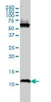 Western Blot: ATPase Inhibitory Factor 1 Antibody (3E2) [H00093974-M01] - Western Blot analysis of ATPIF1 expression in MCF-7 ( Cat # L046V1 ).