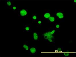 Immunocytochemistry/Immunofluorescence: ATPase Inhibitory Factor 1 Antibody (3E2) [H00093974-M01] - Immunofluorescence of monoclonal antibody to ATPIF1 (H00093974-M01) on MCF-7 cell . [antibody concentration 10 ug/ml]