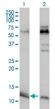 Western Blot: ATPase Inhibitory Factor 1 Antibody (3E2) [H00093974-M01] - analysis of ATPIF1 expression in transfected 293T cell line by ATPIF1 monoclonal antibody (M01), clone 3E2. Lane 1: ATPIF1 transfected lysate (12 KDa). Lane 2: Non-transfected lysate.