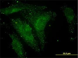 Immunocytochemistry/Immunofluorescence: NELL1 Antibody (6A8) [H00004745-M01] - Immunofluorescence of monoclonal antibody to NELL1 on HeLa cell . [antibody concentration 10 ug/ml]