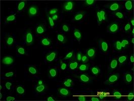 Immunocytochemistry/Immunofluorescence: WDR20 Antibody (2A6) [H00091833-M02] - WDR20 (H00091833-M02) on HeLa cell . [antibody concentration 10 ug/ml]