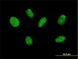 Immunocytochemistry/Immunofluorescence: ZNF471 Antibody [H00057573-B01] - Immunofluorescence of purified MaxPab antibody to ZNF471 on Daoy cell. [antibody concentration 10 ug/ml]