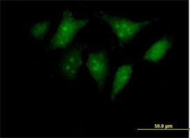 Immunocytochemistry/Immunofluorescence: RBED1 Antibody [H00084173-B01] - Immunofluorescence of purified MaxPab antibody to RBED1 on HeLa cell. [antibody concentration 10 ug/ml]