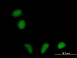 Immunocytochemistry/Immunofluorescence: RILPL1 Antibody [H00353116-B01] - Immunofluorescence of purified MaxPab antibody to FLJ39378 on HeLa cell. [antibody concentration 10 ug/ml]