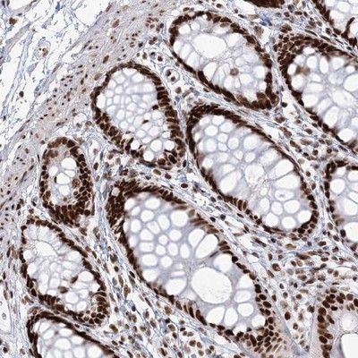 Immunocytochemistry/Immunofluorescence: TMEM9 Antibody [NBP1-80675] - Staining of human rectum shows strong nuclear positivity in glandular cells.
