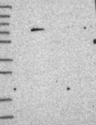 Western Blot: C1orf94 Antibody [NBP1-91724] - Lane 1: Marker [kDa] 250, 130, 95, 72, 55, 36, 28, 17, 10 | Lane 2: RT-4 | Lane 3: U-251 MG | Lane 4: Human Plasma | Lane 5: Liver | Lane 6: Tonsil