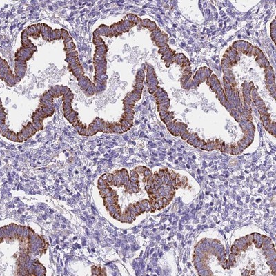 Immunohistochemistry-Paraffin: C1orf94 Antibody [NBP1-91724] - Staining of human uterus, pre-menopause shows strong cytoplasmic positivity in glandular cells.