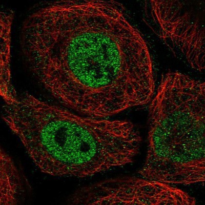 Immunocytochemistry/Immunofluorescence: GERP Antibody [NBP1-89775] - Immunofluorescent staining of human cell line A-431 shows positivity in nucleus but not nucleoli.