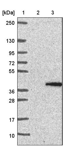 Western Blot: Morg1 Antibody [NBP1-92132] - Lane 1: Marker [kDa] 250, 130, 95, 72, 55, 36, 28, 17, 10<br/>Lane 2: Negative control (vector only transfected HEK293T lysate)<br/>Lane 3: Over-expression lysate (Co-expressed with a C-terminal myc-DDK tag (~3.1 kDa) in mammalian HEK293T cells, LY403158)