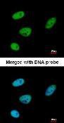 Immunocytochemistry/Immunofluorescence: UCKL1 Antibody [NBP1-32432] - Analysis of paraformaldehyde-fixed HeLa, using UCKL1 antibody at 1:200 dilution.