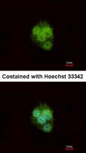 Immunocytochemistry/Immunofluorescence: ZNF397 Antibody [NBP1-32422] - Analysis of methanol-fixed Hep G2, using antibody at 1:500 dilution.