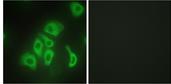 Immunocytochemistry/Immunofluorescence: SEMA4A Antibody [NBP1-68154] - Analysis of HepG2 cells, using TNFA Antibody. The picture on the right is treated with the synthesized peptide.