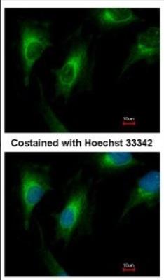 Immunocytochemistry/Immunofluorescence: HLA DRB3 Antibody [NBP2-16854] - Immunofluorescence analysis of methanol-fixed HeLa, using antibody at 1:500 dilution.