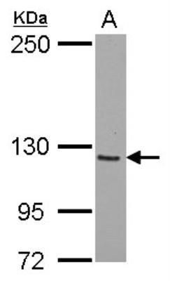 Western Blot: SmarcAL1 Antibody [NBP2-20414] - A: A549.