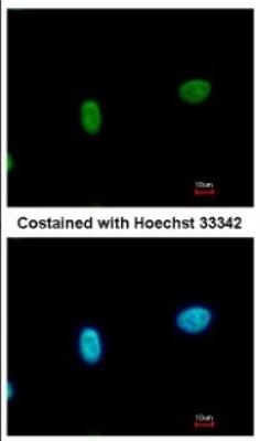Immunocytochemistry/Immunofluorescence: SmarcAL1 Antibody [NBP2-20414] - Immunofluorescence analysis of paraformaldehyde-fixed A549, using antibody at 1:500 dilution.