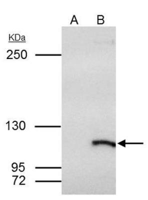 Immunoprecipitation: SmarcAL1 Antibody [NBP2-20414] - A549 whole cell extract.  A. Control with 4 ug of preimmune Rabbit IgG. B. Immunoprecipitation of SMARCAL1 protein by 4 ug SmarcAL1 antibody.