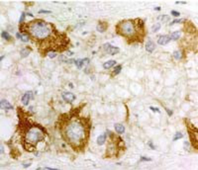 Immunohistochemistry-Paraffin: PACAP Receptor Antibody [NB100-74485] - Human myenteric ganglia cells of the small intestine using NB100-74485.