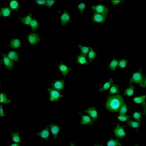 Immunocytochemistry/Immunofluorescence: PAQR8 Antibody [NB100-74515] - Progestin Receptor beta in NS-1 cells.