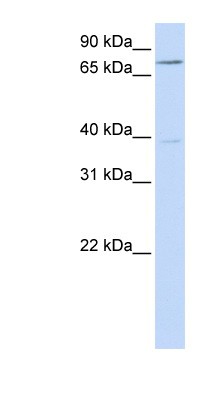 Western Blot: C17orf80 Antibody [NBP1-59973] - Hela cell lysate, concentration 0.2-1 ug/ml.