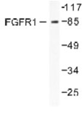 Western Blot: FGFR1OP Antibody [NB100-91765] - (WB) analysis of FGFR1OP (N371) antibody in extracts from HepG2 cells.