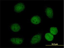 Immunocytochemistry/Immunofluorescence: HDAC7 Antibody [H00051564-B01] - Immunofluorescence of purified MaxPab antibody to HDAC7A on HeLa cell. [antibody concentration 20 ug/ml]