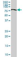 Western Blot: Breast cancer suppressor candidate 1 Antibody [H00004013-B01] - LOH11CR2A MaxPab polyclonal antibody (B01), Lot # 08009 WULz. Western Blot analysis of LOH11CR2A expression in human stomach.