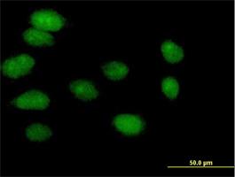 Immunocytochemistry/Immunofluorescence: TOM1L2 Antibody [H00146691-B01] - Immunofluorescence of purified MaxPab antibody to TOM1L2 on HeLa cell. [antibody concentration 10 ug/ml]