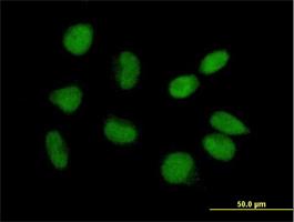 Immunocytochemistry/Immunofluorescence: CGI-09 Antibody [H00051605-B01] - Immunofluorescence of purified MaxPab antibody to CGI-09 on HeLa cell. [antibody concentration 10 ug/ml]