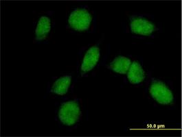 Immunocytochemistry/Immunofluorescence: FANCM Antibody [H00057697-B01P] - Immunofluorescence of purified MaxPab antibody to FANCM on HeLa cell. [antibody concentration 10 ug/ml]