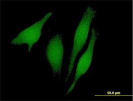 Immunocytochemistry/Immunofluorescence: RUSC1 Antibody [H00023623-B01] - Immunofluorescence of purified MaxPab antibody to RUSC1 on HeLa cell. [antibody concentration 10 ug/ml]