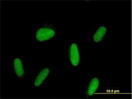 Immunocytochemistry/Immunofluorescence: ZNF192 Antibody [H00007745-B01] - Immunofluorescence of purified MaxPab antibody to ZNF192 on HepG2 cell. [antibody concentration 10 ug/ml]